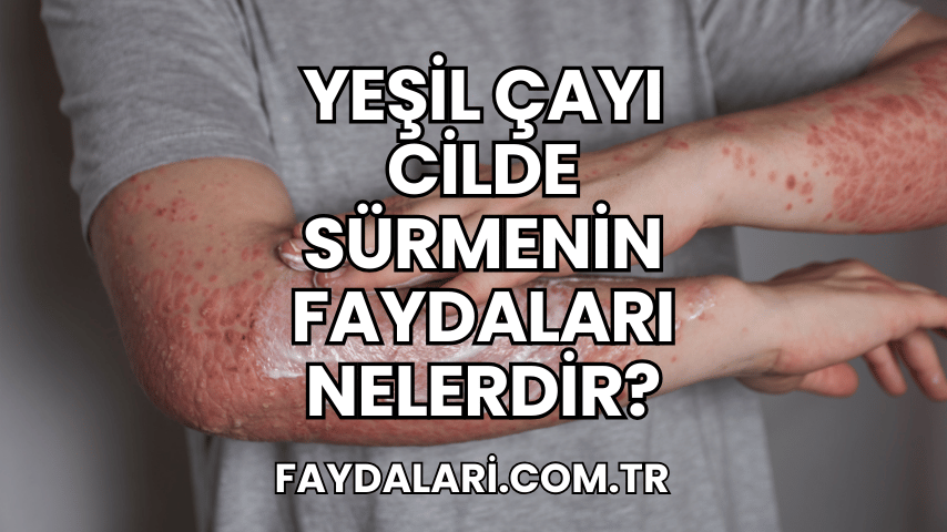 Yeşil Çayı Cilde Sürmenin Faydaları Nelerdir?